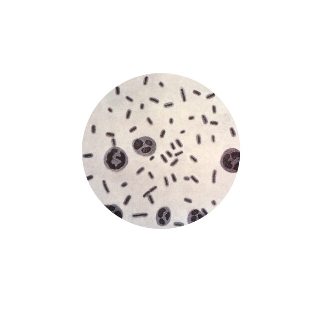 Klebsiella pneumoniae